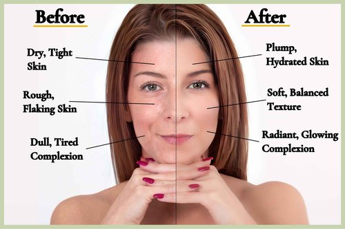 Goldcrest Naturals Moisturizing Face Mask For Dry Skin - Organic & Natural Skincare With Neem & Clay - Hydrates & Softens Skin - 100% Plant-Based, Cruelty-Free, Preservative-Free, & Eco-Friendly, 7 oz