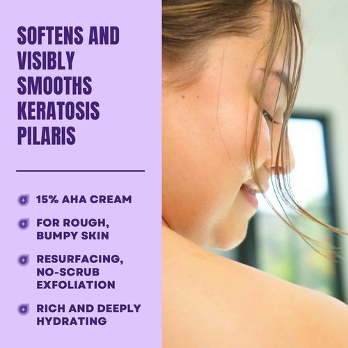 AmLactin KP Bumps Be Gone - Therapeutic Body Cream for Keratosis Pilaris - No-Scrub Exfoliator and Moisturizer with 15% Lactic Acid AHA, 3 oz, Pack of 2 (Packaging May Vary)