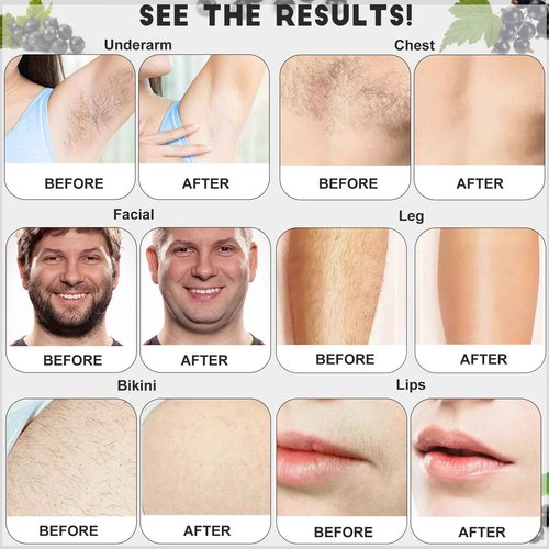 2.5 lb Bulk Sensitive Skin Wax Beads for Hair Removal, Waxing Beads for Coarse and Fine Hair, Gentle Formula for Body Brazilian Waxing, Bikini Face Leg Underarm Back Chest, Includes 20 Sticks
