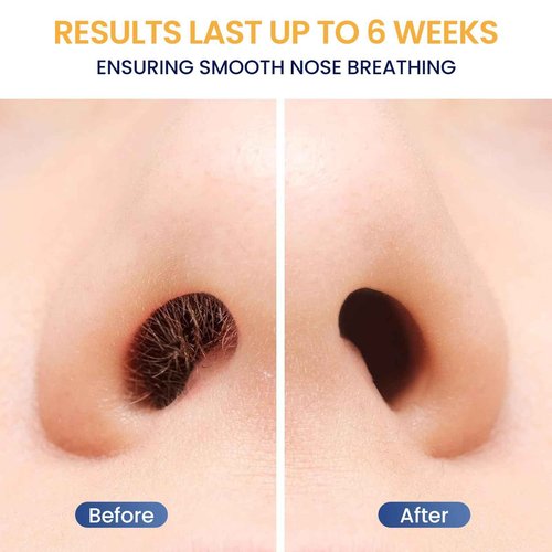 Nose Hair Wax Kit for Men, Nose Wax Removal with 100 g Wax, 40 Applicators, 15-20 Times, Ear Nasal Hair Waxing For Men and Women, Usb Rapid Heating, Constant Temperature, Painless, Black