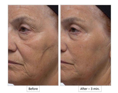 Dr. Denese Wrinkle Lost Line Reducer, 3 Minute Age Eraser With Silk Protein Fiber Technology