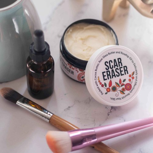 Better Shea Butter Scar Eraser Balm - Cocoa Butter Cream for Stretch Marks and Dark Spots, Burns, Old Scars - Acne Scars - Designed w Zero Synthetic Ingredients, 4 oz