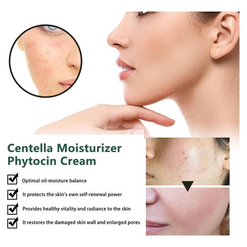 YAMFIUY Centella Moisturizer Phytocin Cream - Phytocin Cream, Moisturizer & Hydration, Improve Roughness, Smooth Skin, For Sensitive Skin with Natural Centella Asiatica Extract 2pcs