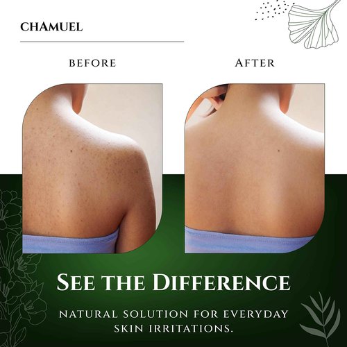 Chamuel Tea Tree Balm & Body Wash - The Best Product Combo to Soothe a Wide Variety of Skin Irritations