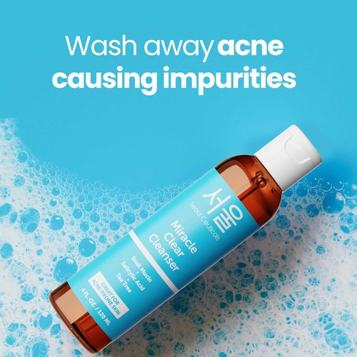 Zombie Acne Kit - Korean Skin Care Treatment for Acne Prone Skin - Rapid Action Salicylic Acid, Tea Tree & Clove For Even Skin Tone