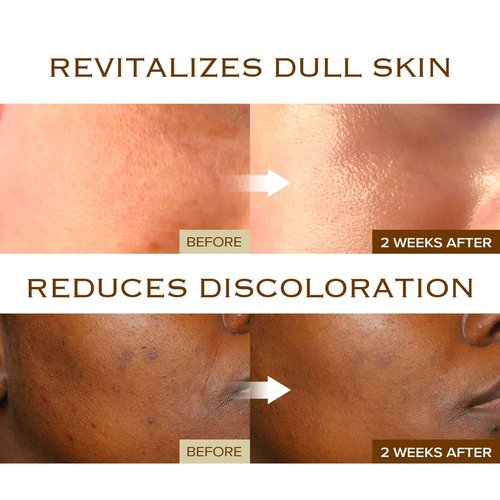 mimmua! Glow Reset Toner | Korean Clinic Skincare - Thioctic Acid & Niacinamide 5% | Gentle Exfoliation w/Pumpkin Extract | Fades Dark Spots & Acne Scars | Deep Hydration | 250ml /8.45 Fl Oz