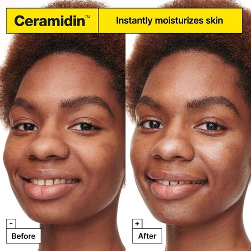 Dr. Jart+ Ceramidin Moisture Treats Korean Skin Care Ornament Gift Set, Travel Size Ceramide Face Moisturizer and Full Size Lip Balm for Hydration and Skin Barrier Repair, Limited Edition Holiday Set