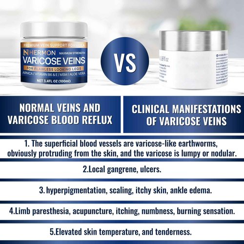 Hermon Varicose and Spider Veins Cream – Natural Formula to Improve Circulation, Soothe Tired Legs & Reduce Swelling – 3.4 Fl Oz (3.4 Fl Oz (Pack of 1))