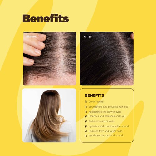 GINGER MILK SOS Hair Growth Kit with Biotin & Ginger, Vegan Hair Care Set with Growth Serum, Shampoo, Nourishing Mask & ampoule. Natural Formula Strengthens Roots, Reduces Hair Loss