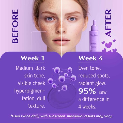 Felor Shop by Maryam Skin Pigmentation Corrector Serum, Niacinamide and Peptide MAX, 1.69 fl oz, Dark Spot Treatment