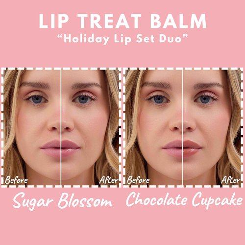 Crickle Daisy Lip Treat Balm - Hydrating & Nourishing Lip Balm with Avocado, Olive, and Coconut Oils - Softening Lip Moisturizer & Protection for Very Dry Lips - 1x Sugar Blossom & 1x Chocolate, 0.7oz
