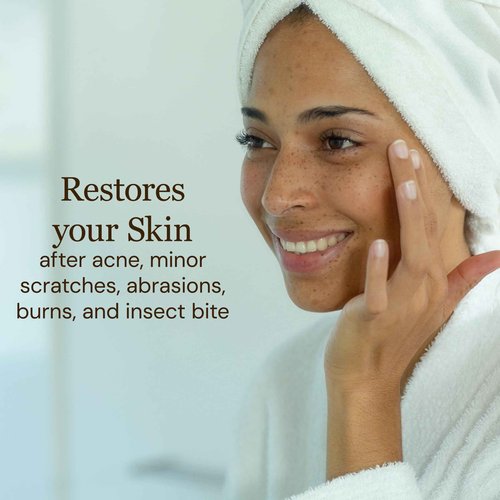 Elina Organics Sea Buckthorn Healing Lotion, 4oz – Soothing Moisturizer with MSM, Black Willow Bark & Zinc Oxide – Organic, Vegan – Repairs Acne, Redness & Skin Irritation