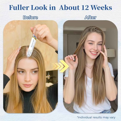 Hair Growth Serum Roll On 25ml/0.84Oz with Saw Palmetto, Rosemary & Pea Extract，Helps Support Thicker, Fuller Hair Appearance, Non-Greasy Hair Loss Support for Men & Women (2pcs)