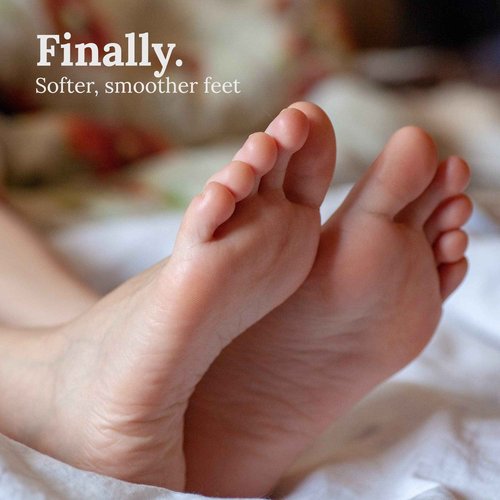 GILDEN TREE Max Strength 42% Urea Gel + Premium Terra Cotta Foot Scrubber Bundle
