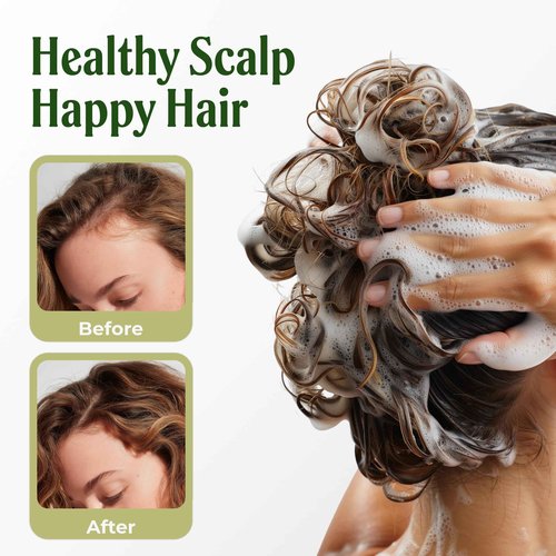 Carolayage Rosemary Shampoo for Hair Growth & Strength | Sulfate-Free, Paraben-Free, Silicone-Free | Infused with Red Onion Extract, Biotin & Rosemary | Reduces Hair Loss & Supports Scalp Health