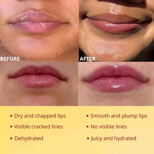 Original My Bee Balm Lip Balm – Hydrating Lip Care with Watermelon, Strawberry & Honey Pot – Moisturizing Balm for Dry, Chapped & Cracked Lips with Propolis, Honey & Vitamin E