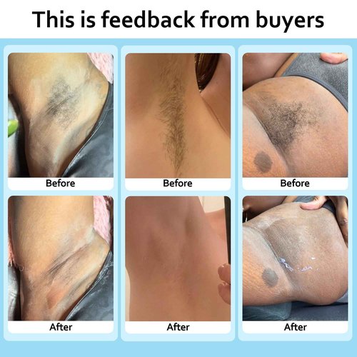 EarayWax Waxing Kit for Women Men, Wax Warmer Hair Removal at Home with Hard Wax Beads & Silicone Pot, Suitable for Sensitive Skin Brazilian Bikini, Facial, Underarms, Legs, Full body