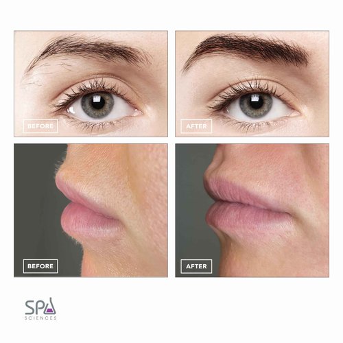 SPA SCIENCES - AIVA Deluxe - Dual 2-in-1/Double Sided Facial Hair Remover & Eyebrow Trimmer USB Rechargeable with Built-in LED Lights & 2 Extra Replacement Heads
