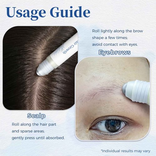Hair Growth Serum Roll On 25ml/0.84Oz with Saw Palmetto, Rosemary & Pea Extract，Helps Support Thicker, Fuller Hair Appearance, Non-Greasy Hair Loss Support for Men & Women (2pcs)