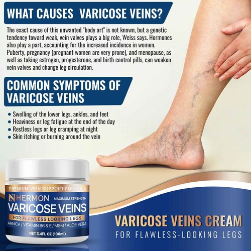 Hermon Varicose and Spider Veins Cream – Natural Formula to Improve Circulation, Soothe Tired Legs & Reduce Swelling – 3.4 Fl Oz (3.4 Fl Oz (Pack of 1))