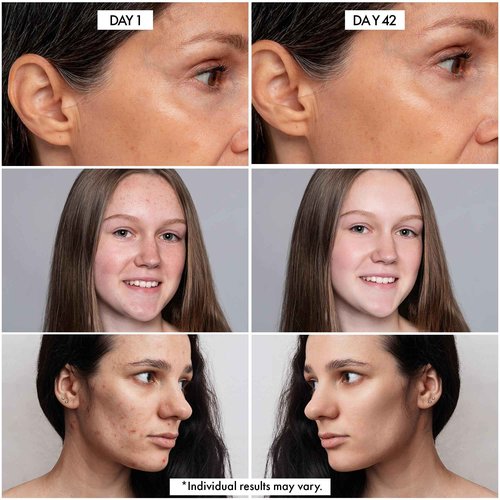 Dr. Crazy Millionaire Glow Vitamin C Serum for Face - Hydrating Glow Up Serum With Turmeric, Niacinamide, Hyaluronic Acid, Snail Mucin & Vitamin E - Fades Dark Spots & Evens Skin Tone – 30ml