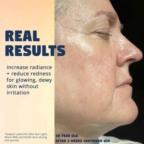 Zen Dew Star Light Korean Snail Mucin Serum (3.38 oz) Brightening & Hydrating K Beauty Face Serum for Glass Skin Glow – Smoothing Korean Skin Care