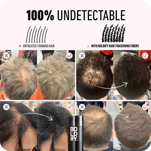 Boldify Hair Fiber + Hairline Powder: Build & Conceal Bundle - Undetectable Hair Thickener for Fine Hair, Instant Stain-Proof Root Touchup Powder, For Men & Women (Dark Brown)