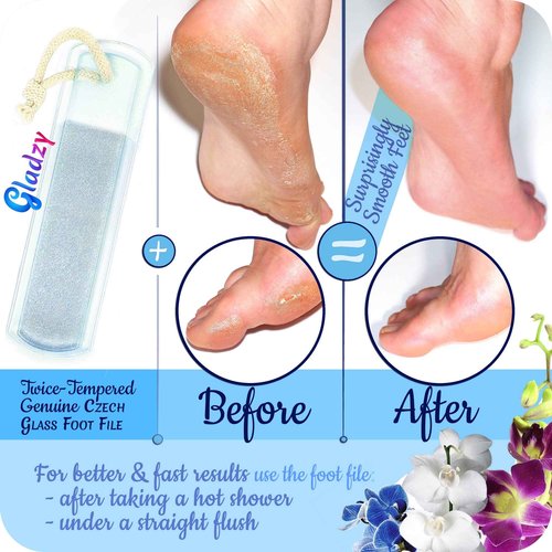 GLADZY Czech Glass Nail File Set - Multifunctional Nail Shiner Buffer, Callus Remover Foot Rasp, Glass Cuticle Pusher Manicure Stick, Etched Surface, Professional Nail Care Tool, Made in EU