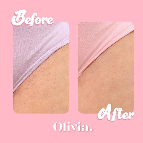 Olivia Aurora Bikini Scrub – Sweet-Scented Exfoliant for Intimate Area – Prevents Ingrown Hairs, Fades Dark Spots & Smooths Skin – Natural, No Sugar, 8 oz
