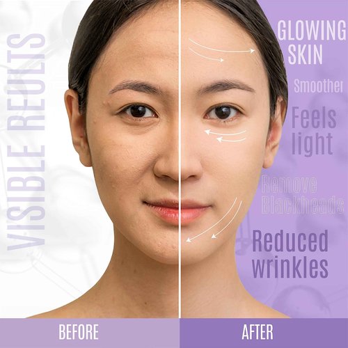 Dermaxgen Lift & Firm 30% Peptide Serum for Face – Anti-Aging Serum with Vitamin C, E, Matrixyl 3000, Aloe Vera & Hyaluronic Acid – Multi-Peptide Formula to Lift, Firm & Rejuvenate Skin (8 fl oz)