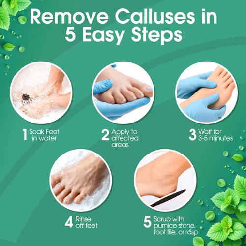 DeEnti Callus Remover for Feet, Extra Strength Foot Callus Remover Gel, 128oz Gallon Salon Grade Bulk Pedicure Supplies for Dry Skin, Cracked Heel, Professional Strength Foot Care, Cool Mint