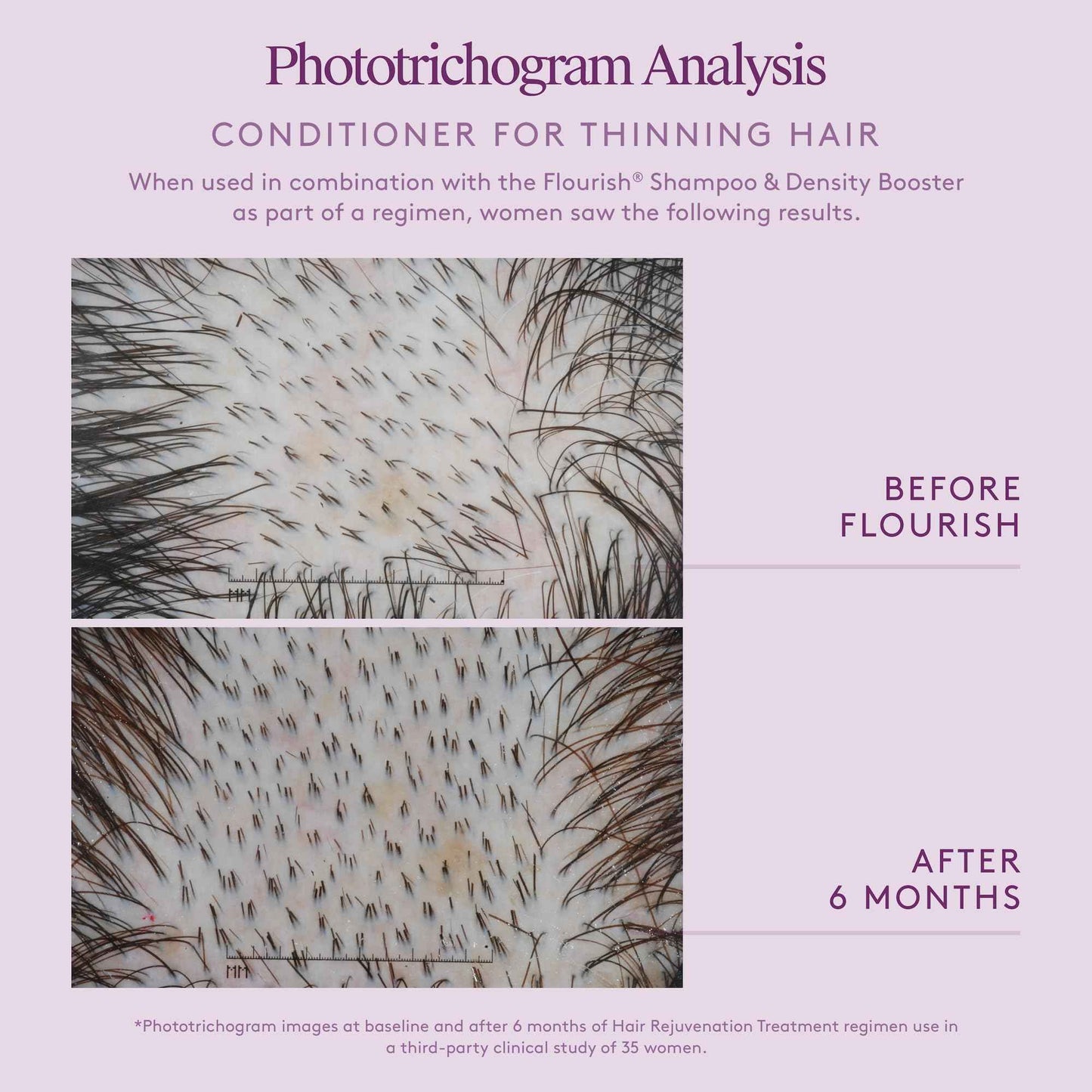 Virtue Flourish Conditioner for Thinning Hair | Nourishes, Thickens, Detangles Thinning Hair