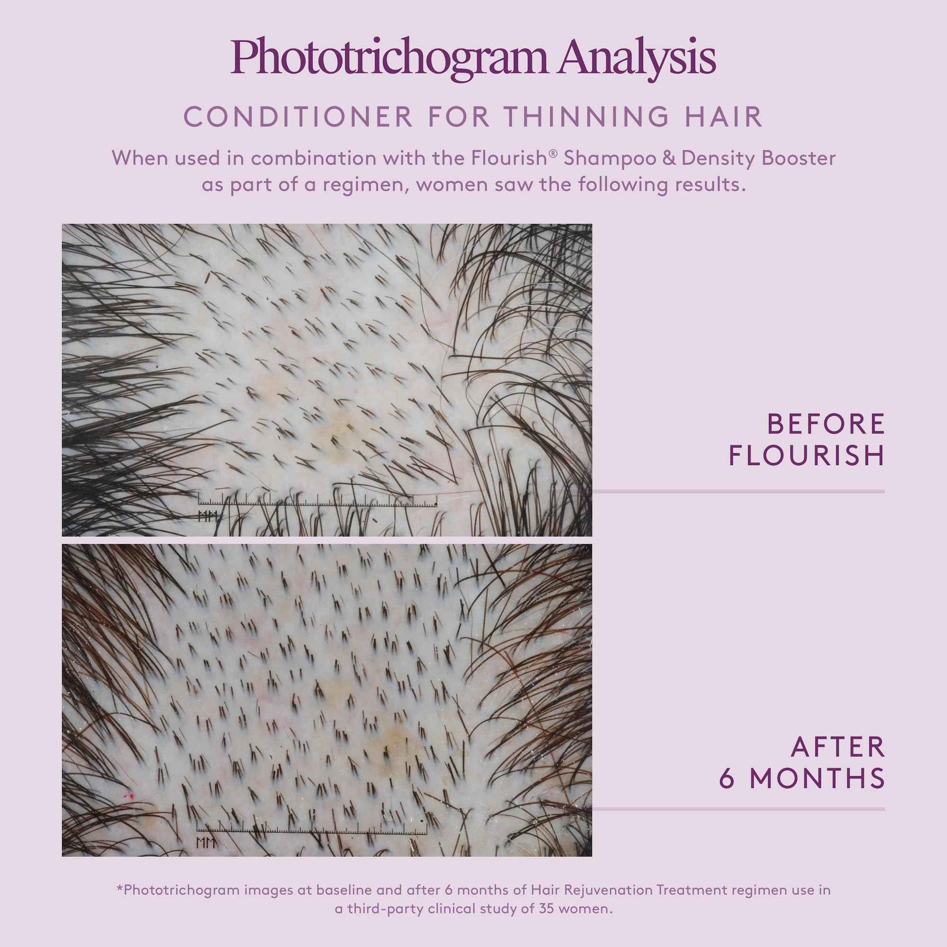 Virtue Flourish Conditioner for Thinning Hair | Nourishes, Thickens, Detangles Thinning Hair