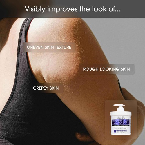 Advanced Clinicals Retinol Body Cream Moisturizer + Exfoliating 10% Glycolic Acid & Lactic Acid Lotion 2PC Skincare Set For Women & Men To Reduce Appearance Of Crepey Skin & Uneven Rough Skin Texture
