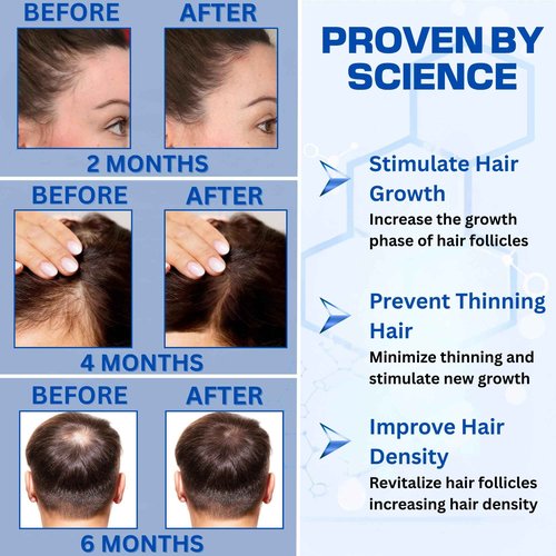Copper Peptide Hair Serum – 10% GHK-Cu + 5% AHK-Cu Peptides for Hair Growth & Scalp Health – Advanced Regrowth Treatment for Thicker, Fuller Hair