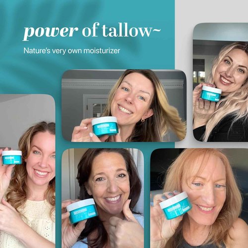Forge Skin® Tighten & Lift Balm for Women [TALLOW-BASED] - Beef Tallow & Honey Extract Face Moisturizer - Natural Cream - Hydrating Facial Lotion - Anti Aging Skincare with Essential Oils (1.7 OZ)