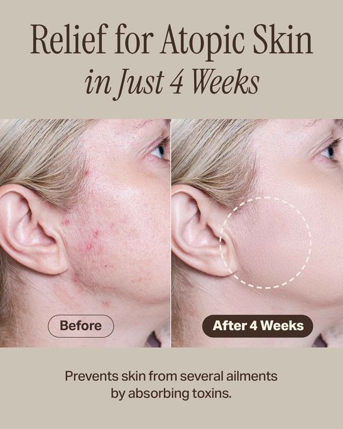 Celeb's Choice Skin Care Bundle | Recovery Mud Clay Face Mask + Mud Pack to Foam Facial Cleanser | K-Mud Mask | Celeb Choice Mask | Celeb Choice Cleanser