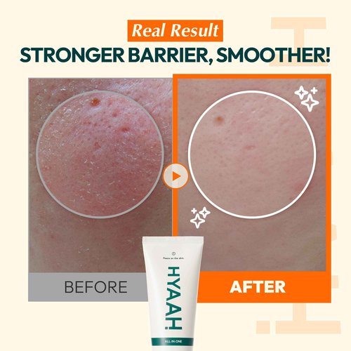 HYAAH All-in-one Ectoin Lotion - Korean Face Moisturizer with Ectoin, Squalane and Ceramide - Hydrating, Pore Care, Barrier Strengthening - Gentle on All Skin Types, 3.38 fl.oz.