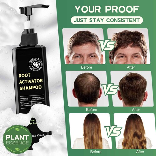 Root Activator Shampoo for Hair Growth - Natural Formula DHT Blocker with Fo-Ti Root and Ginger to Strengthen Follicles, Shampoo for Man & Women to Thinning and Lost Hair