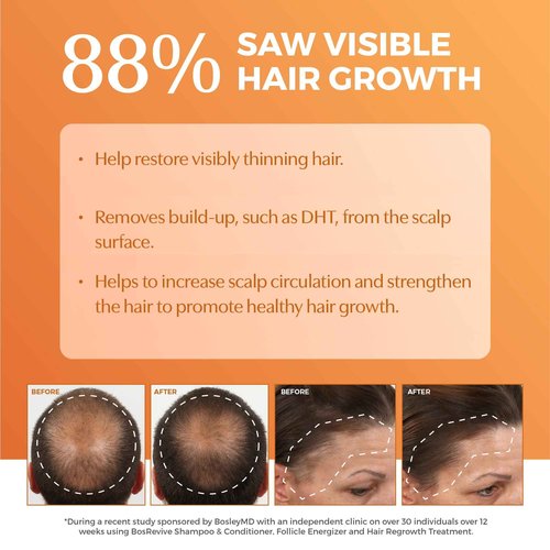 BosRevive Nourishing Shampoo for Thinning Hair (Color Safe) – DHT Blocker, Sulfate-Free, Vegan Formula with Biotin, Saw Palmetto & Rosemary – Strengthens & Volumizes – 33.8 Fl Oz