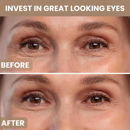 M.D. Blend Plant Stem Cell Eye Serum Complex | Aloe Vera, Vitamin C | Hydrating Eye Treatment | Airless Pump - 15ml