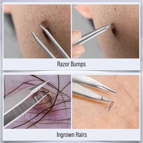 DUROX Precision 4-Piece Tweezer Set 1. Safety Tweezers for Facial Hair Removal for Women 2. Pointed Tip for Ingrown Hairs & Splinters 3. Precision Slant for Eyebrows 4. Classic Slant. Stainless Steel