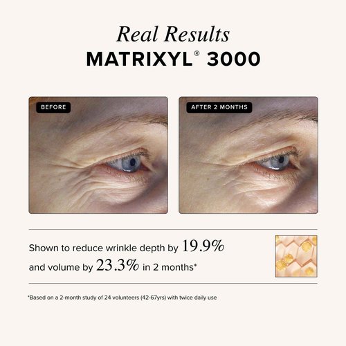 Asterwood Matrixyl 3000 + Argireline Serum with Hyaluronic Acid - Anti-Aging, Wrinkle Reducing, Collagen Boosting - Fragrance-Free - 4 Fl Oz