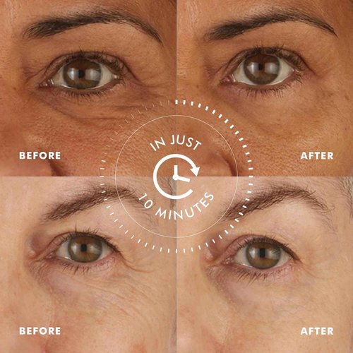 Skyn ICELAND Hydro Cool Firming Under Eye Patches, Instant Cooling for Puffy, Tired Eyes with Peptides and Coenzyme Q10, 10 Minute Treatment, Vegan, All Skin Types, 12 Pairs