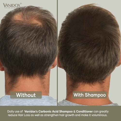 VANIDOX Carbonic Acid Shampoo and Conditioner for Men and Women, Deep Moisturizing Conditioner, Thickens, Softens, & Smooths Set for Hair Growth and Repair, Made in USA - 16 Fl Oz Each