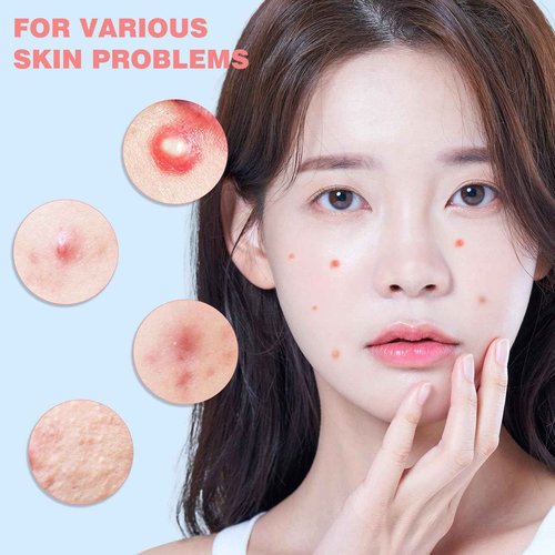 HLOES Pimple Patches for Face 360PCS, Hydrocolloid Acne Patches for Covering Zits and Blemishes, Cute Star Pimple Patches, Facial Skin Care Products.