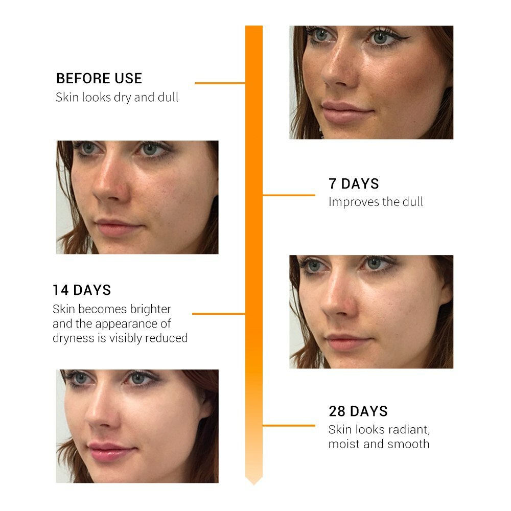 Advanced Vitamin C Anti-Aging Cream - Matrixyl 3000 & Hyaluronic Acid