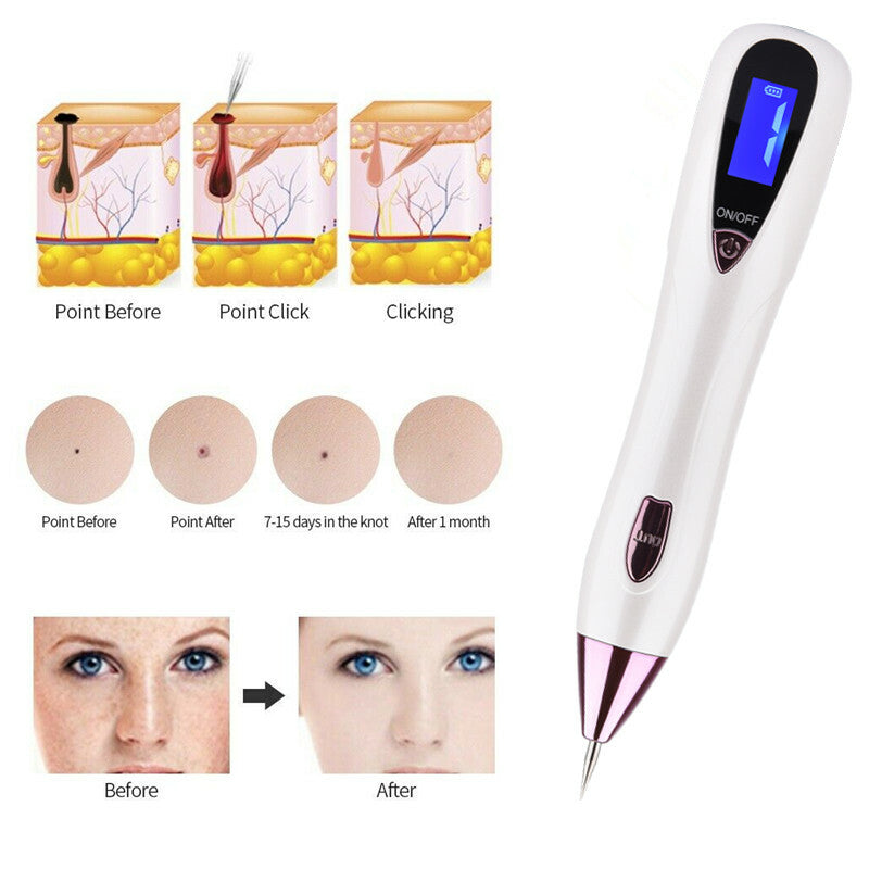 Rechargeable Plasma Pen for Eyelid Lift Wrinkle & Spot Removal Kit