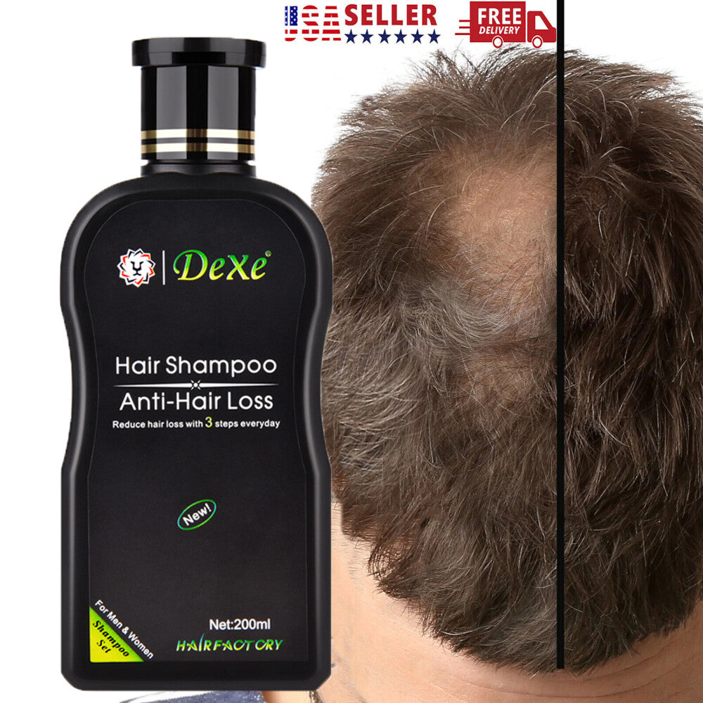 Anti-Hair Loss Shampoo for Men & Women - 200ml