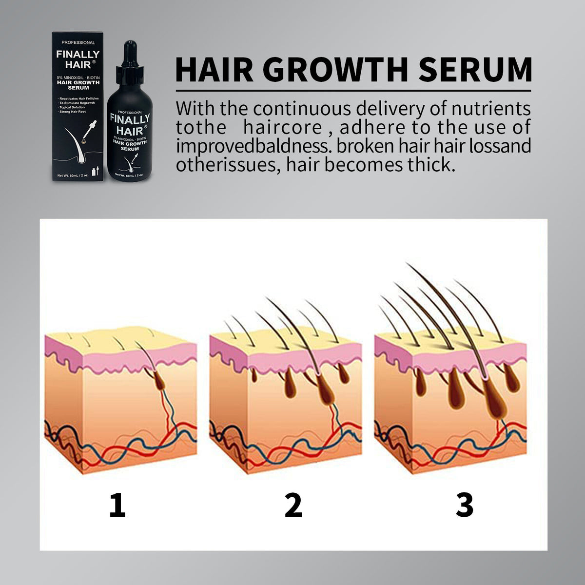 Minoxidil 5% Hair Growth Serum with Biotin & Collagen